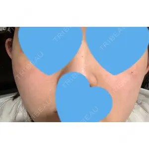 聖心美容クリニック グループ S-Laboクリニック 渋谷院口コミ