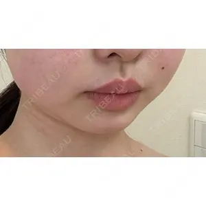 藤・ナチュレ美容クリニック 藤・ナチュレ美容クリニック 銀座院口コミ