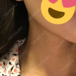 湘南美容クリニック 湘南美容クリニック 新宿南口院口コミ