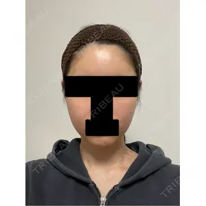セギム美容整形外科口コミ