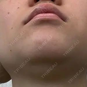 渋谷美容外科クリニック 渋谷美容外科クリニック 新宿院口コミ