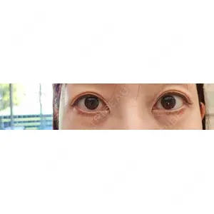 APOLLO BEAUTY CLINIC口コミ