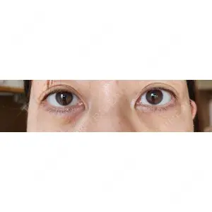 APOLLO BEAUTY CLINIC口コミ