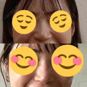 リッツ美容外科 大阪院口コミ