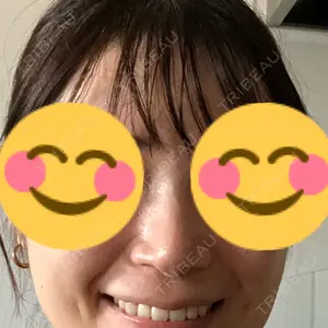 リッツ美容外科 大阪院口コミ