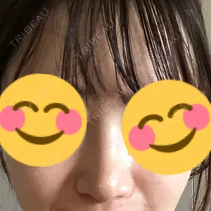 リッツ美容外科 大阪院口コミ