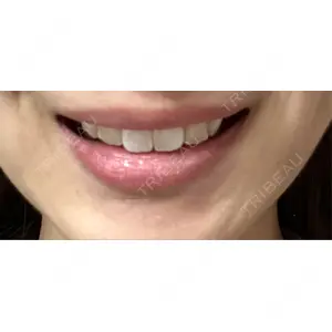 口コミ