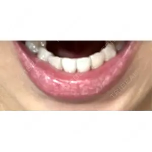 口コミ