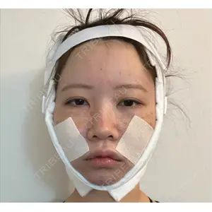セギム美容整形外科口コミ
