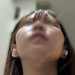 セギム美容整形外科口コミ