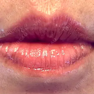 口コミ