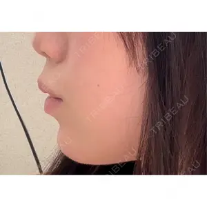 HAAB×DREAM BEAUTY CLINIC HAAB×DREAM BEAUTY CLINIC 大阪梅田院口コミ
