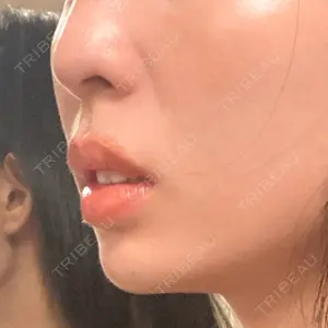 ルラ美容クリニック ルラ美容クリニック 大宮院口コミ