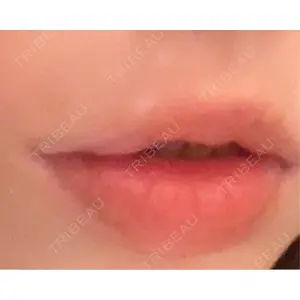 LOUIS CLINIC 二子玉川院【ルイクリニック】口コミ