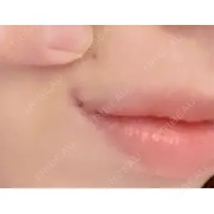LOUIS CLINIC 二子玉川院【ルイクリニック】口コミ