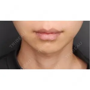 Tokyo Tensei Clinic Tokyo Tensei Clinic 新宿院口コミ