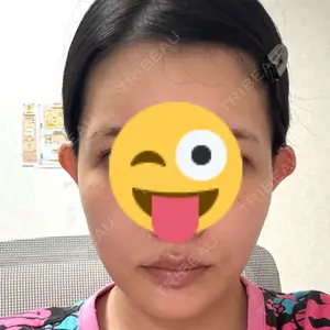 口コミ
