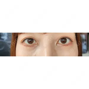 APOLLO BEAUTY CLINIC口コミ