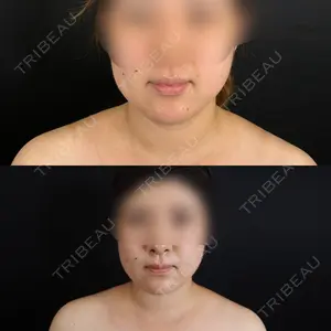 藤・ナチュレ美容クリニック 藤・ナチュレ美容クリニック 銀座院口コミ