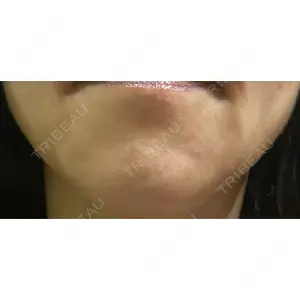 BON BON CLINIC BON BON CLINIC 銀座駅前本院口コミ