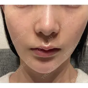 口コミ