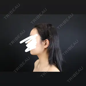 藤・ナチュレ美容クリニック 藤・ナチュレ美容クリニック 銀座院口コミ