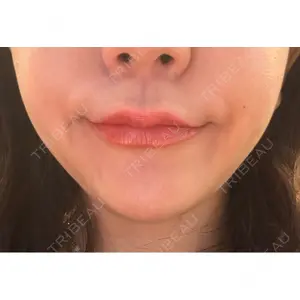 L‘amour clinic Tokyo【ラムールクリニック東京】口コミ