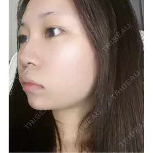 MIO CLINIC 梅田院口コミ