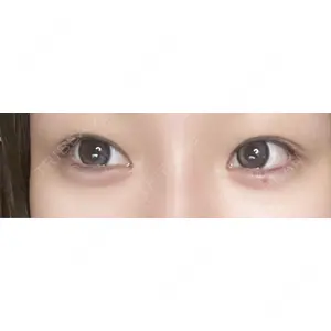 MIO CLINIC 梅田院口コミ
