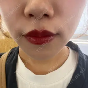 銀座みゆき通り美容外科 銀座みゆき通り美容外科 大阪梅田院口コミ