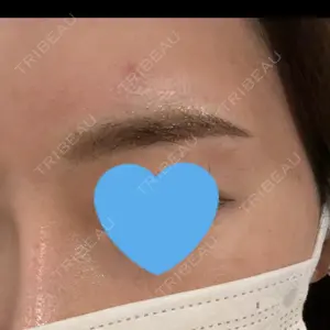 APスキンクリニック銀座口コミ