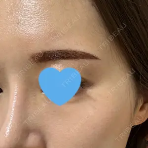 APスキンクリニック銀座口コミ