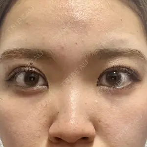 湘南美容クリニック 湘南美容クリニック 池袋東口院口コミ
