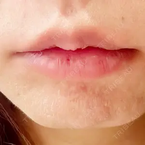 R Beauty CLINIC R Beauty CLINIC 銀座院口コミ