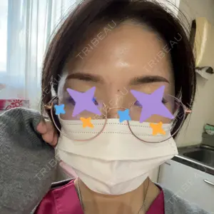 APスキンクリニック銀座口コミ