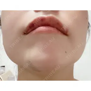HAAB×DREAM BEAUTY CLINIC HAAB×DREAM BEAUTY CLINIC 大阪梅田院口コミ