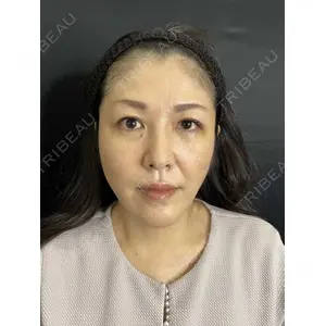 藤・ナチュレ美容クリニック 藤・ナチュレ美容クリニック 銀座院口コミ