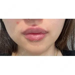 R Beauty CLINIC R Beauty CLINIC 銀座院口コミ