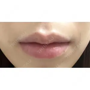 口コミ