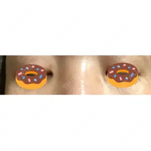 TCB東京中央美容外科 TCB東京中央美容外科 立川院口コミ