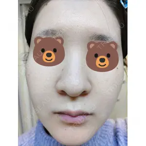 ブリリアスキンクリニック口コミ