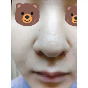 ブリリアスキンクリニック口コミ