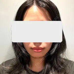 口コミ