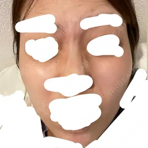 DMTC美容皮膚科 DMTC美容皮膚科 渋谷院口コミ