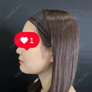 藤・ナチュレ美容クリニック 藤・ナチュレ美容クリニック 銀座院口コミ