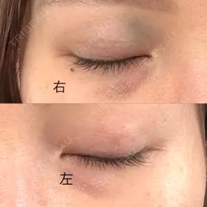 TCB東京中央美容外科 TCB東京中央美容外科 秋葉原院口コミ