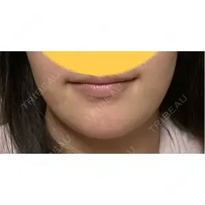 銀座マイアミ美容外科の