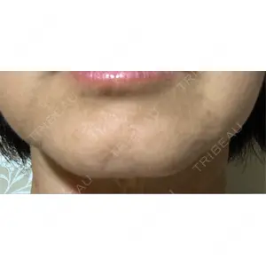 湘南美容クリニック 湘南美容クリニック 新宿本院口コミ