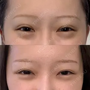 藤・ナチュレ美容クリニック 藤・ナチュレ美容クリニック 銀座院口コミ