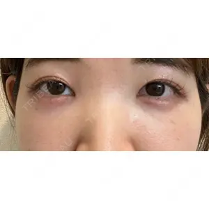 東京シンデレラ美容外科 東京シンデレラ美容外科 池袋院口コミ